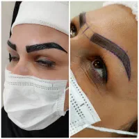 کاشت مو و ابرو در گلپایگان