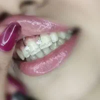 پیرسینگ گوش ،بینی،لب،میکرودرمال،چالگونه