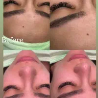 تخفیف ویژه فیشال و پاکسازی بهار