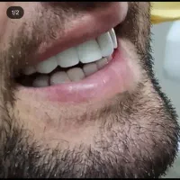 دندانپزشکی نورآباد با ۳۰ درصد تخفیف