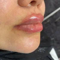 کرمپودر دائم و ژل و بوتاکس و هایفو|خدمات آرایشگری و زیبایی|اهواز, کیانپارس |دیوار