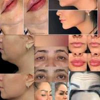 خدمات زیبایی تخصصی با قیمت‌های استثنایی|خدمات آرایشگری و زیبایی|مشهد, راهنمایی|دیوار