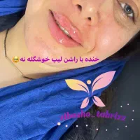 آموزش تزریق ژل بوتاکس مزو نخ ودیگر لاین های زیبایی|خدمات آموزشی|تبریز, |دیوار