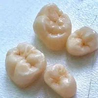 نیرو خانم جهت  دندانسازی