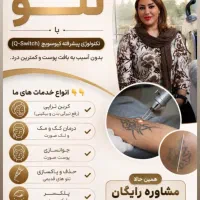 پاک کردن تتو و خالکوبی بدون آسیب به پوست