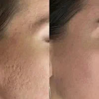 کلینیک نگین سبز|خدمات آرایشگری و زیبایی|بجنورد, |دیوار