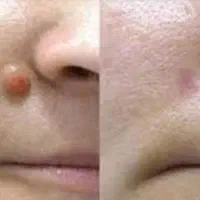 سوراخ کردن گوش و بینی و خالبرداری وچال گونه|خدمات آرایشگری و زیبایی|زاهدان, |دیوار