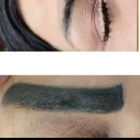 ریموو تک جلسه ای تضمینی|خدمات آرایشگری و زیبایی|مهران (ایلام), |دیوار