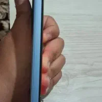 redmi not 11pro+5|موبایل|لردگان, |دیوار
