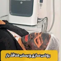 کربن تراپی روشن سازی پوست ورفع تیرگی نواحی بدن