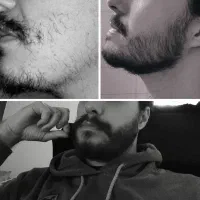 بدون عوارض مو درییار