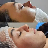 عمل بینی