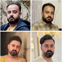 کاشت مو تضمینی و اقساطی در محیطی کاملا vip|خدمات آرایشگری و زیبایی|یزد, |دیوار