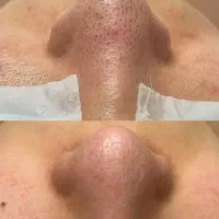 خدمات فشیال تخصصی خانوم وآقا|خدمات آرایشگری و زیبایی|سنندج, |دیوار