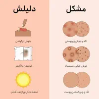 تخفیف ویژه روز جهانی دختر|آرایشی، بهداشتی، درمانی|تربت‌حیدریه, آبشار|دیوار