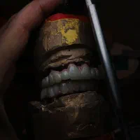 آموزش لابراتوار دندانپزشکی