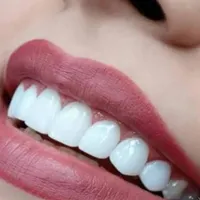 جشنواره ویژه بهاره کامپوزیت