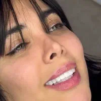 کامپوزیت دندان ۸۰ درصد تخیف|خدمات زیبایی و سلامت|تهران, صادقیه|دیوار