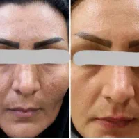 مزاج شناسی و پاکسازی|آرایشی، بهداشتی، درمانی|اهواز, امانیه|دیوار