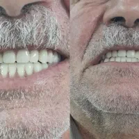 دندانسازی سپیددنتال