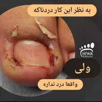 درمان بیماری ناخن و ارتونیل (پودولوژی)|خدمات آرایشگری و زیبایی|اصفهان, سعادت‌آباد|دیوار
