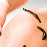 حجامت و زالوتراپی و طب سوزنی‌و پاکسازی بدن از سمو|خدمات آرایشگری و زیبایی|ارومیه, |دیوار