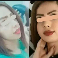 (چاقی طبیعی صورت)با پودر جوانه گندم
