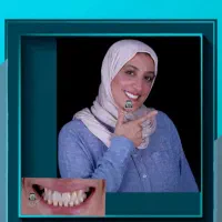 مرکز تخصصی ایمپلنت دندانپزشکی شیراز / تعرفه دولتی