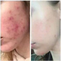 فروش محصولات گلوتاتیون