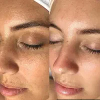 فیشیال پاکسازی پوست