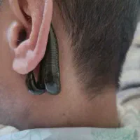 تخفیف حجامت وزالو درمانی ویژه عید سعید غدیرخم