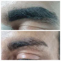 ۱۵٪تخفیف لیزر موهای زائد الکترولیز خالبرداری کربن|خدمات آرایشگری و زیبایی|فولادشهر, B5|دیوار