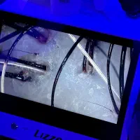 اسکالپ سر پروتئین تخصصی