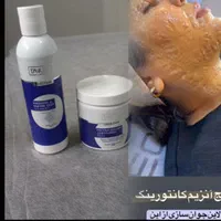 فیشیال و پاکسازی پوست|خدمات آرایشگری و زیبایی|شیراز, قصرالدشت|دیوار