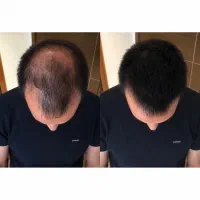 راز موهای پرپشت و خوش‌حالت