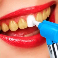 دستگاه سفیدکننده و پولیش دندان اورجینال