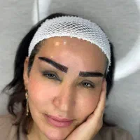 نیازمند مدل با چهره زیبا کاشت ابرو