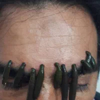 حجامت/رگگیری سیاتیک/زالودرمانی|خدمات آرایشگری و زیبایی|شیراز, عادل آباد|دیوار