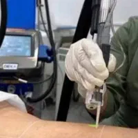 لیزر موهای زائد بدن/دستگاه شاتی دکا