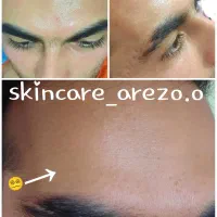 درمان تخصصی پوست درمطب بانوان وآقایان