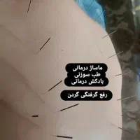 حجامت ، طب سوزنی ، امبدینگ ، بادکش درمانی|خدمات آرایشگری و زیبایی|اندیشه, اندیشه فاز ۳|دیوار