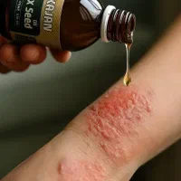 روغن ضد التهاب کتان