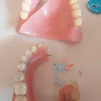 کلینیک  لابراتوار متخصص پروتز دندان دنچر پارسیل|آرایشی، بهداشتی، درمانی|تهران, سعادت‌آباد|دیوار