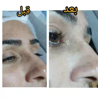 فیشیال تخصصی با قیمت اقتصادی