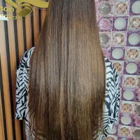 تخفیف ویژه احیاء مو