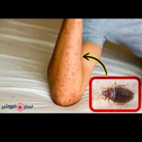 سمپاشی سوسک کابینتی‌ ریزودرشت موش وغیره...|خدمات نظافت|کرمان, |دیوار