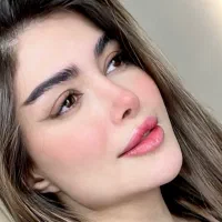 مدل تزریق ژل،فیلر،بوتاکس،لیفت بانخ،جوانساز|خدمات آرایشگری و زیبایی|کرج, مهرویلا شمالی|دیوار
