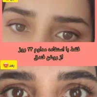 تقویت مژه و ابرو، ریزش مو، کمتر از یک ماه