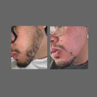 کوسه نباش‌ ریش دار شو