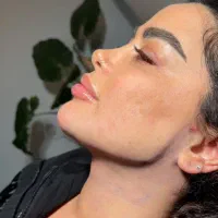 ساکشن غبغب و زاویه سازی دائمی کلینیک مهرزاد